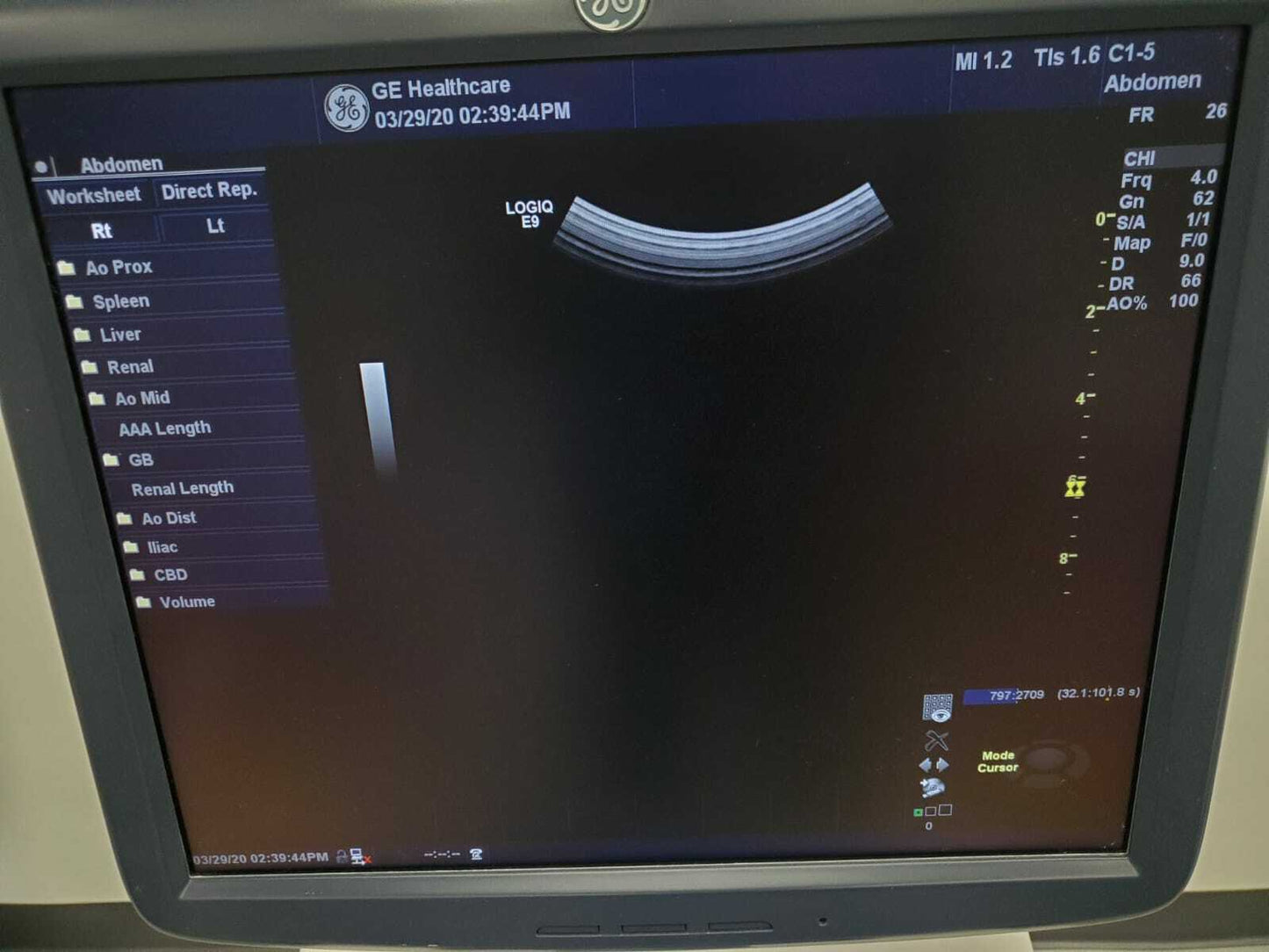 GE LOGIQ E9 XDclear 2.0 Ultrasound