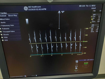 GE LOGIQ E9 XDclear 2.0 Ultrasound