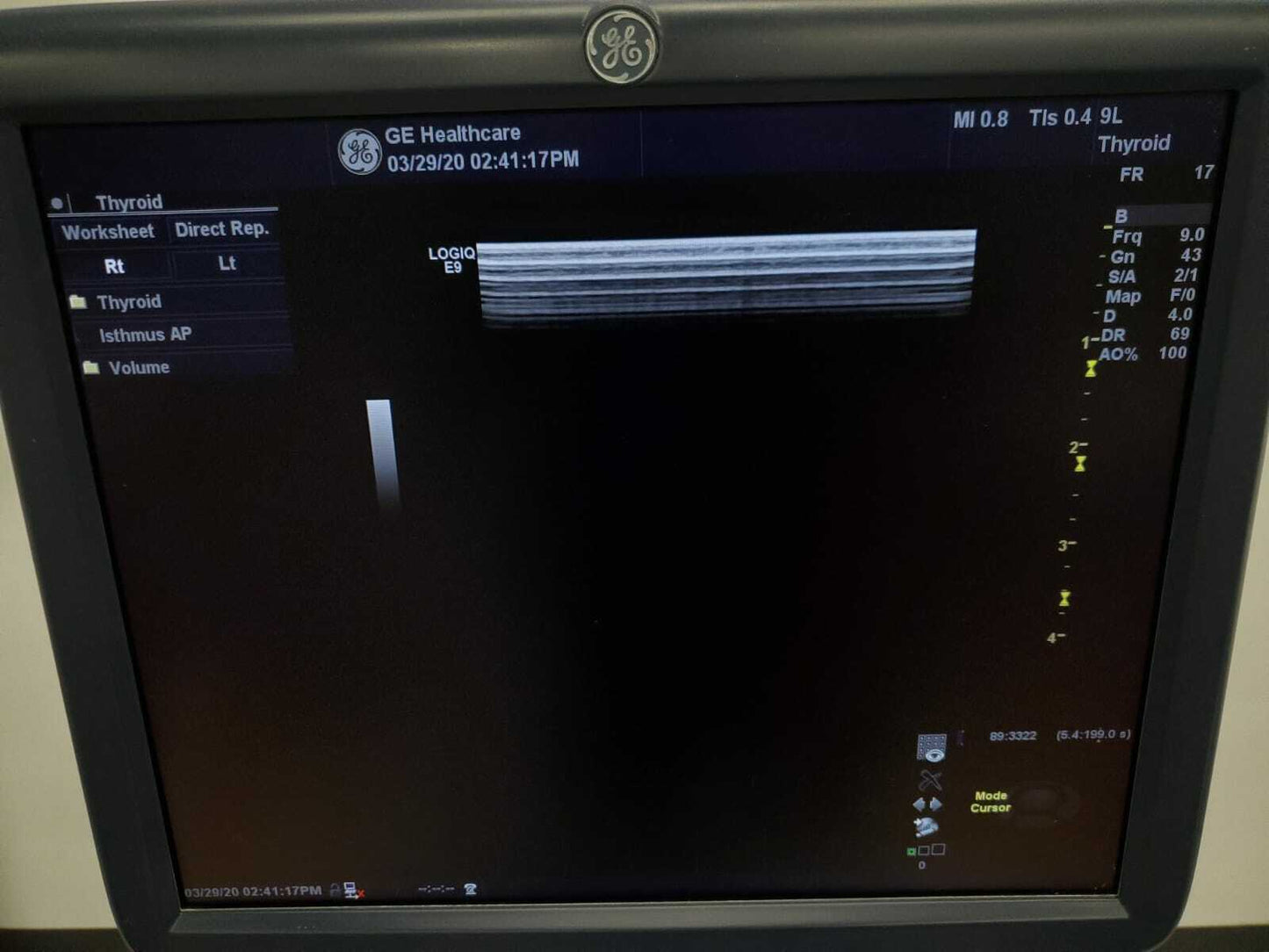 GE LOGIQ E9 XDclear 2.0 Ultrasound