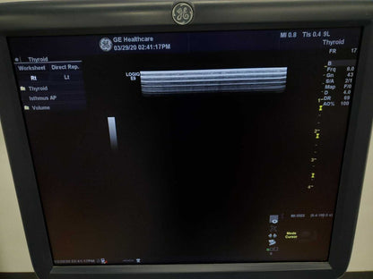 GE LOGIQ E9 XDclear 2.0 Ultrasound