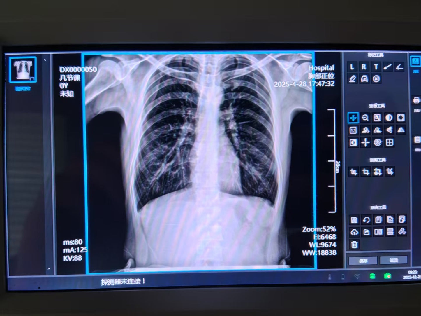 PORTABLE X-RAY MACHINE