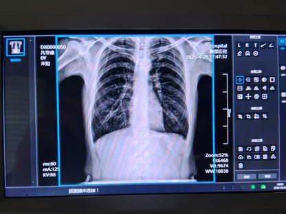 PORTABLE X-RAY MACHINE