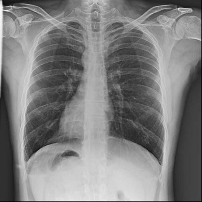 PORTABLE X-RAY MACHINE